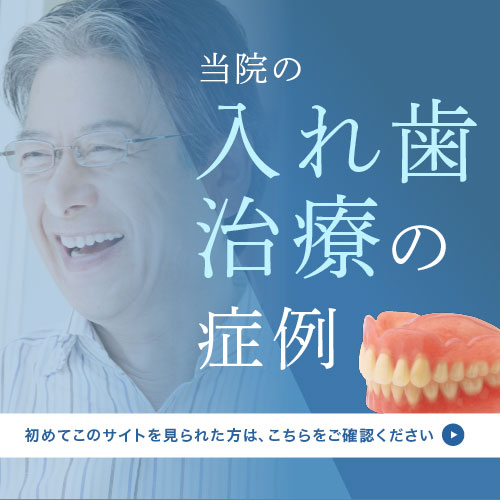 当院の入れ歯治療の症例：初めてこのサイトを見られた方は、こちらをご確認ください